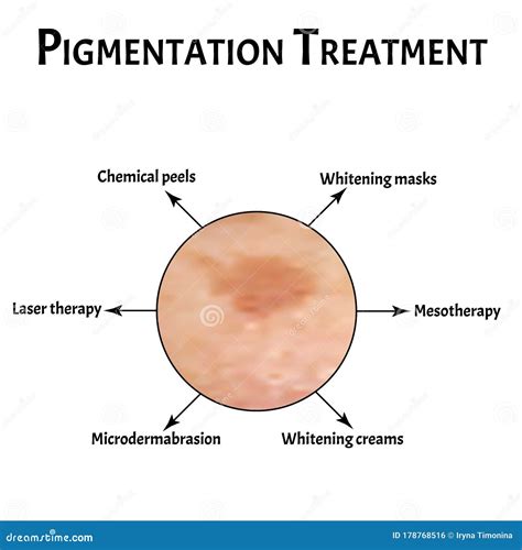 Pigmentation on the Skin. Brown Spots on the Skin. Pigmentation ...