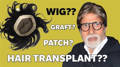 Amitabh Bachchan Hair Transplant Result | Hair Patch | Hair Wig | Minoxidil | Finasteride ...