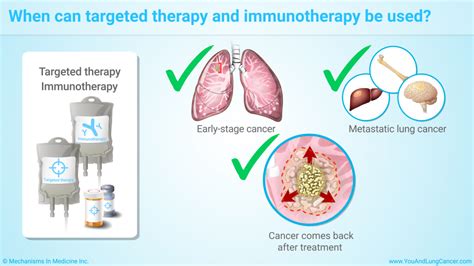 Slide Show - Understanding Biomarker Testing in Non-Small Cell Lung Cancer