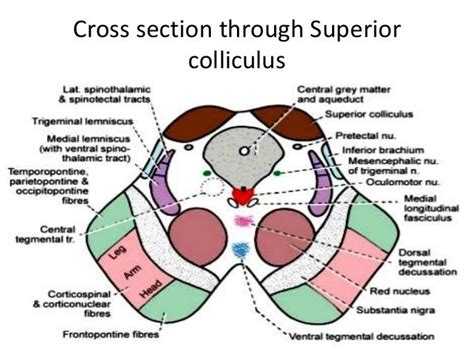 Transverse section through Inferior colliculus Gross Anatomy, Human Anatomy, Gray Matters ...