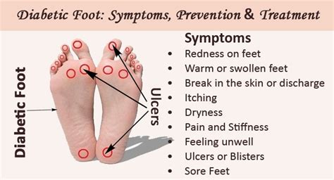 The Best Ways To Prevent Diabetic Foot Ulcers | EVA Orthotic Insoles Manufacturer | Ideastep