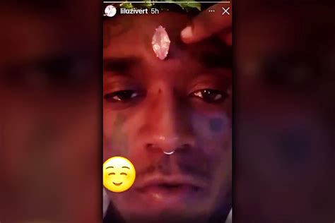 Lil Uzi Vert Insists His Diamond Face Implant Is Centered - XXL