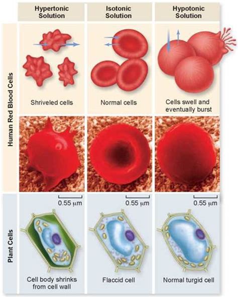 Osmotic Pressure In Cells