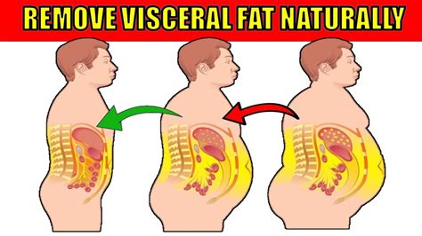 How to Get Rid of Visceral Fat Naturally - YouTube