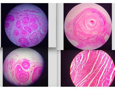 Histology of Blood Vessels and More Quiz