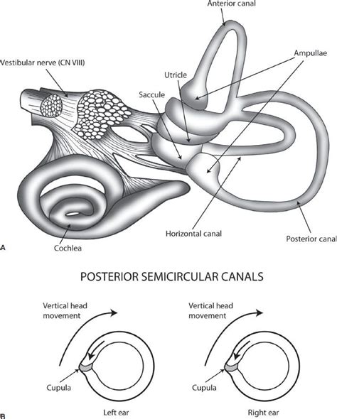 Vertigo | Anesthesia Key