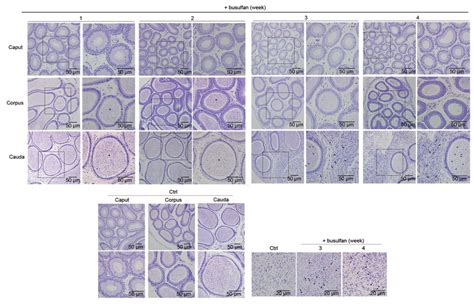 Histology of the epididymis. The caput, corpus, and cauda epididymides... | Download Scientific ...