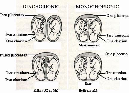 Details more than 144 amniotic fluid bag best - esthdonghoadian