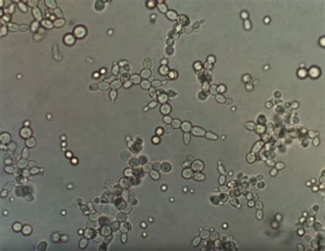 virgin Fall capitalism saccharomyces cerevisiae microscope definitely ...