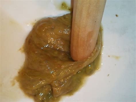 Benign Causes of Greasy Oily Stools — Scary Symptoms