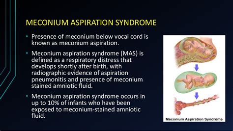 MECONIUM STAINED AMNIOTIC FLUID