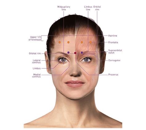 Botox Injection Site Forms