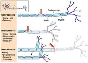 Advances in Resorbable Peripheral Axonal Nerve Guide Technology - Anatomy