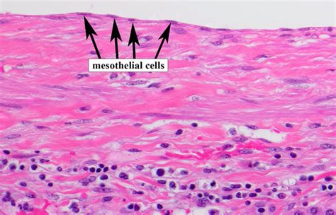 Normal Liver Histology 101 | AASLD