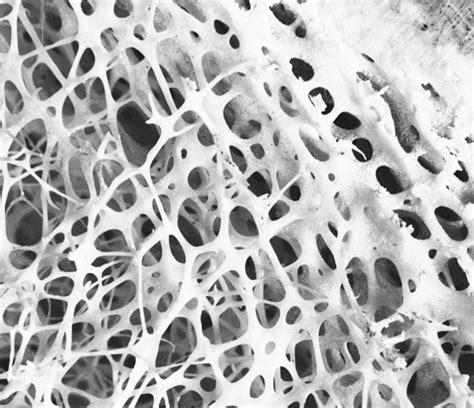 Type of of cellular structures found in nature: Open cell structure in... | Download Scientific ...