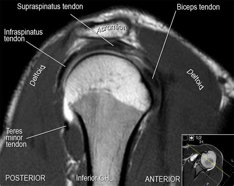 MRI Musculo-Skeletal Section: Sagittal anatomy and checklist