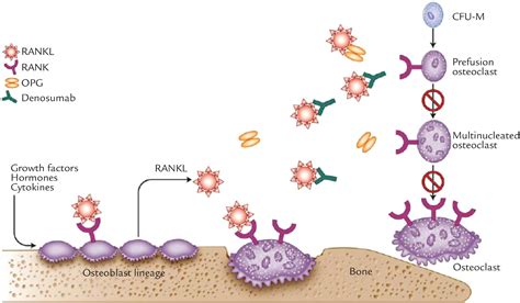 Denosumab for the Reduction of Bone Loss in Postmenopausal Osteoporosis: A Review - Clinical ...