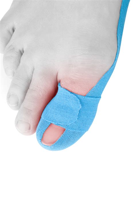 Health Hack: How to Treat a Broken Toe at Home | University of Utah Health