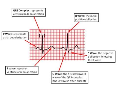 bloopz | P wave, Medical mnemonics, Nursing school studying