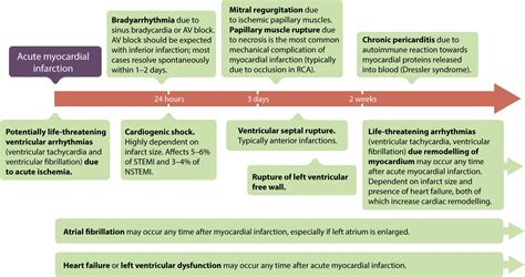 STEMI (ST Elevation Myocardial Infarction): diagnosis, criteria, ECG ...