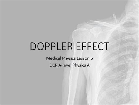 Doppler ultrasound (A-level Medical Physics) | Teaching Resources