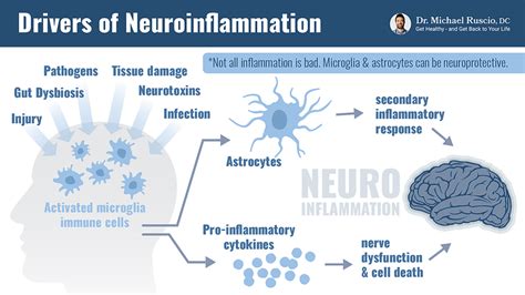 How to Target Neuroinflammation and Beat Brain Fog - Dr. Michael Ruscio, DC