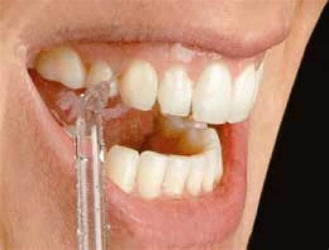 Invest in Your Oral Health: Buy a Waterpik