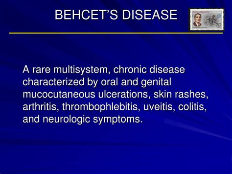 PPT - BEHCET’S DISEASE PowerPoint Presentation, free download - ID:6448387