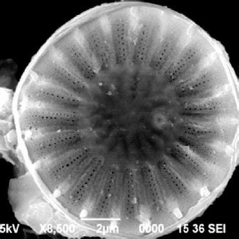 Optical microscopy image of centric diatom, Cyclotella sp . The scale... | Download Scientific ...