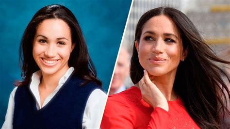 Before and after: Did Meghan Markle have a nose job?