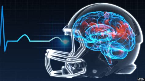 Concussion Screening and Tests - Sadar Psychological and Sports Center