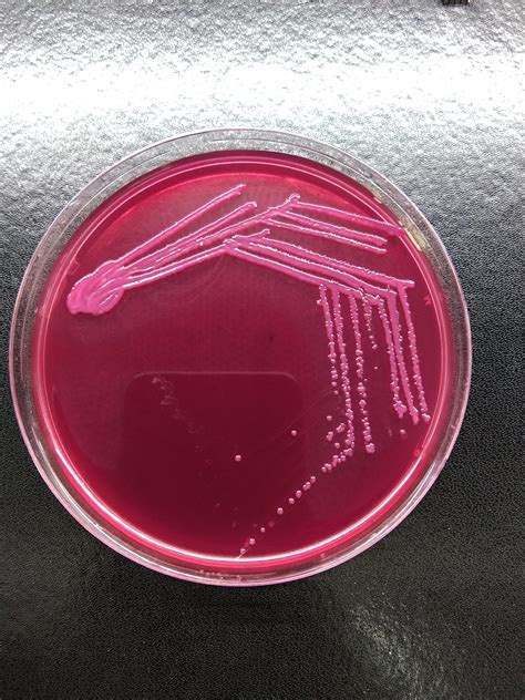 E.coli streaked on MacConkey agar : r/microbiology