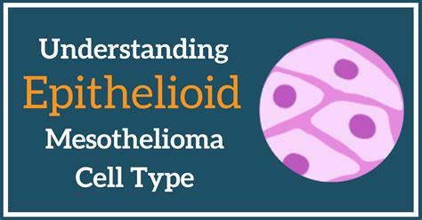 Epithelioid Pleural Mesothelioma