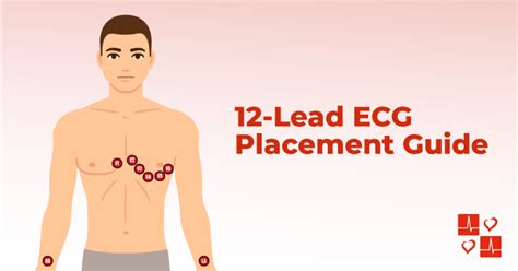 12-Lead ECG Placement Guide - CardiacDirect