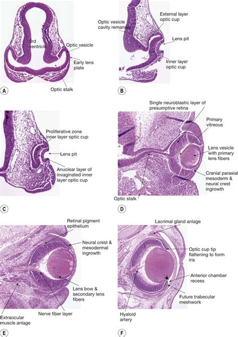 Clinical embryology and development of the eye | Ento Key