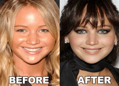 Jennifer Lawrence Nose Job Plastic Surgery Surgeon, Before And After ...