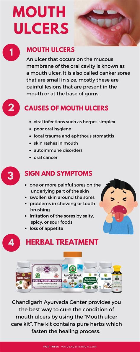 PPT - Mouth Ulcers - Causes, Symptoms and Herbal Treatment PowerPoint Presentation - ID:10121260 ...