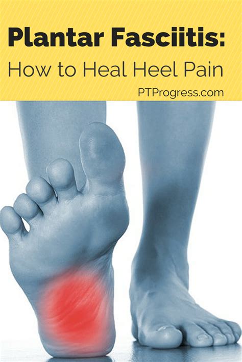 Plantar Fasciitis Treatment: How to Heal Heel Pain