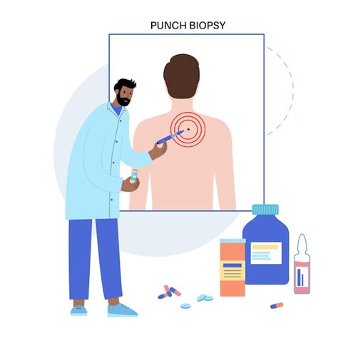 Premium Vector | Punch biopsy procedure