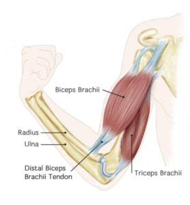 Distal Biceps Tendon Tear – Dr. Edward Weldon