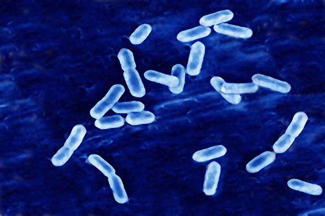 Listeria outbreak 2022 and symptoms to watch out for | Fortune Well