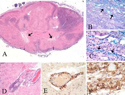 Histology of TM. A: Myelin staining of cervical spinal cord section... | Download Scientific Diagram