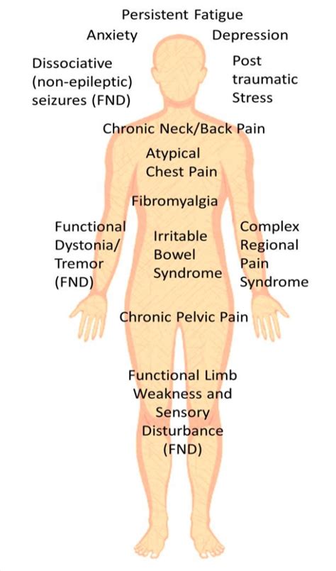 Functional Tics – Functional Neurological Disorder (FND)