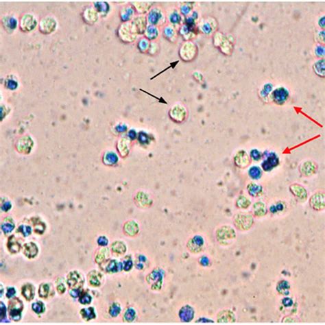 Microscopic image of pus samples (methylene blue stain, 10×... | Download Scientific Diagram