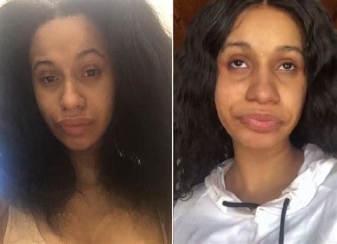 Cardi B Before and After Plastic Surgery: boobs, teeth, nose