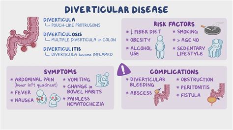 Diverticulitis Vs Diverticulosis