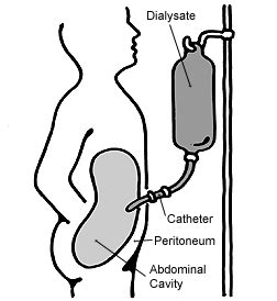 COACH syndrome - Wikipedia