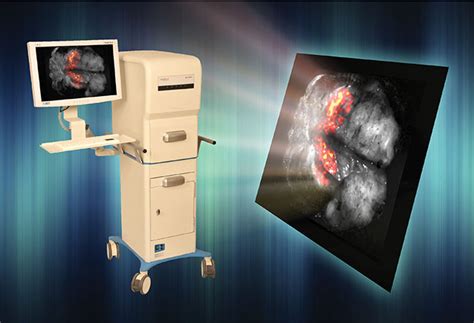 Molecular Imaging Emerges as a Cancer Surgery Tool | Features | Jan ...