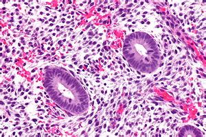 Proliferative phase endometrium - Libre Pathology