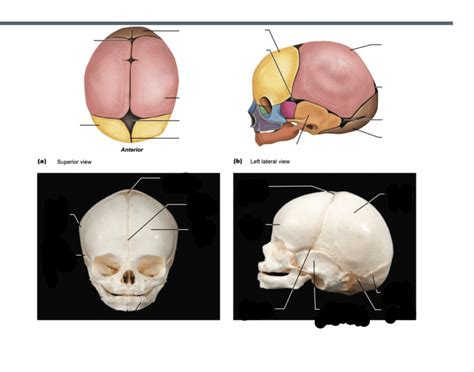 fetal skull anatomy Quiz